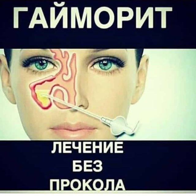 Советы и рецепты по лечению гайморита в домашних условиях