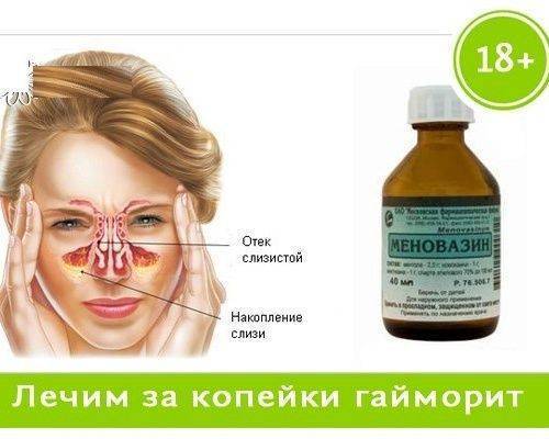 Средство от гайморита в домашних условиях – что можно применить?