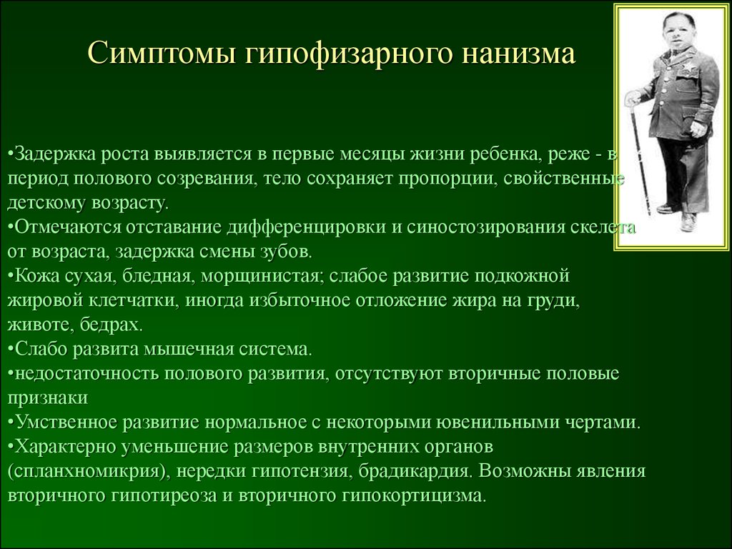 Гипофизарный нанизм: причины, симптомы, диагностика и лечение