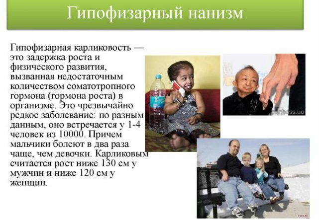 Гипофизарный нанизм. лечение, прогноз