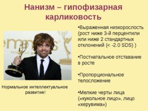 Гипофизарный нанизм. лечение, прогноз