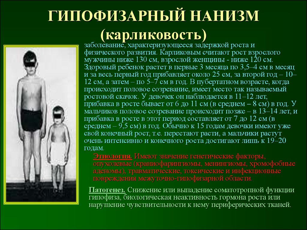 Гипофизарный нанизм (карликовость). причины, симптомы, эффективное лечение.