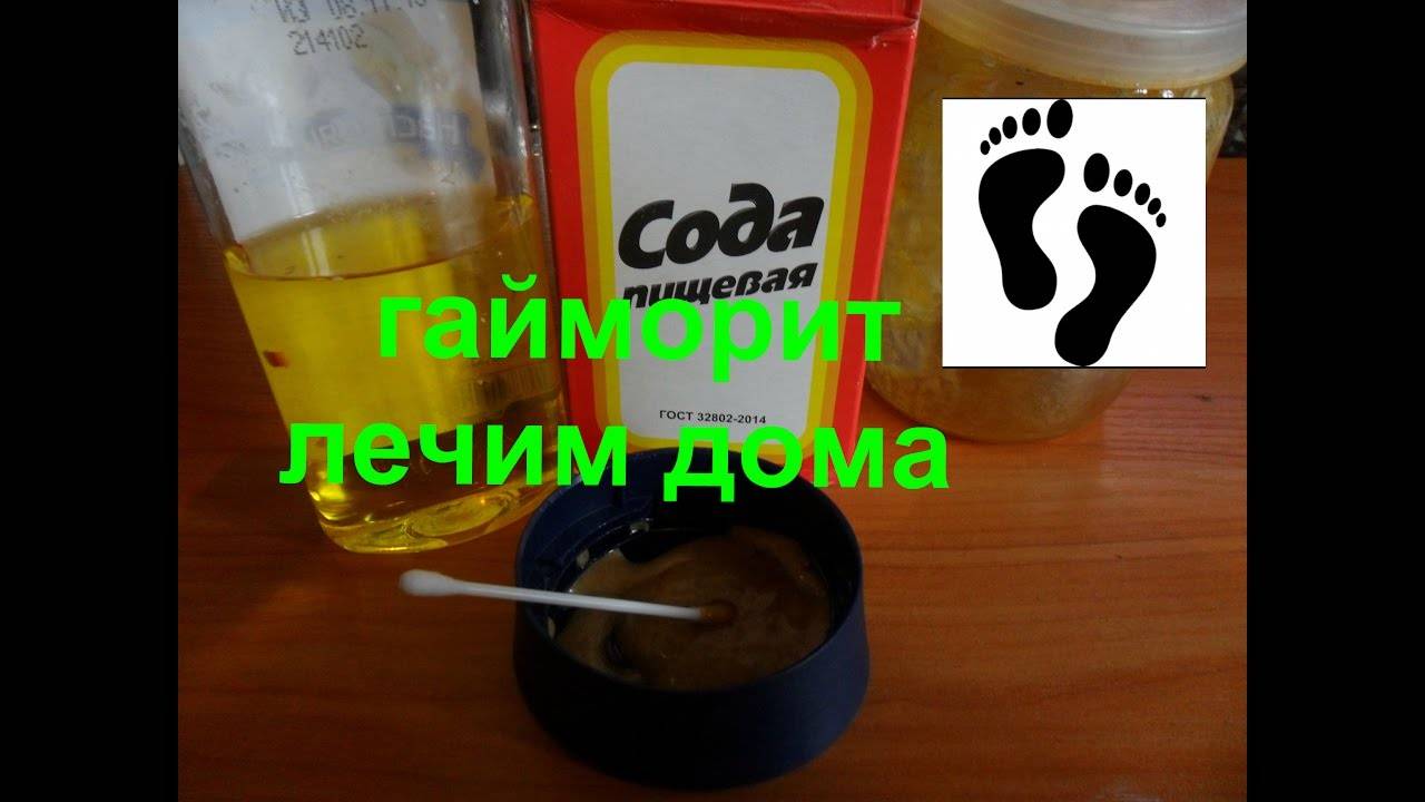 Лечение гайморита народными средствами, лекарствами и процедурами