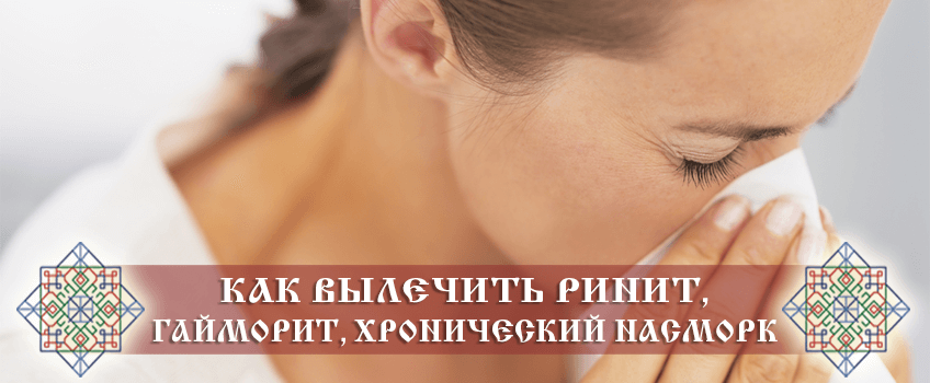 Ринит аллергический - описание, причины, диагностика, лечение.