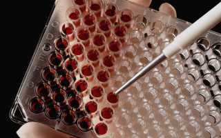 Маркеры инфаркта миокарда