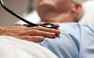 Лечение стенокардии Принцметала