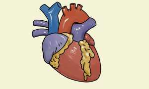 Лечение сердца в Израиле