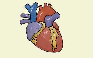 Лечение сердца в Израиле