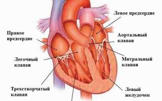 Шумы в сердце