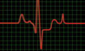 Пульс здорового человека в минуту