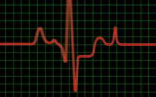 Пульс здорового человека в минуту