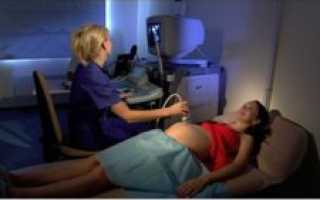 Эхокардиография плода