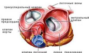 Ложная хорда левого желудочка