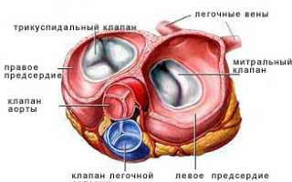 Ложная хорда левого желудочка