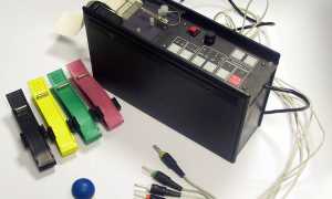 Синдром Бругада