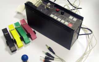 Синдром Бругада