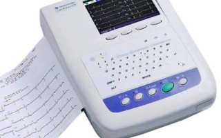 Тахикардия лечение народными средствами