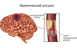 Реабилитация в Израиле