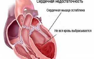 Лечение отеков ног при сердечной недостаточности