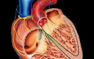 Симптомы и лечение миокардиодистрофии