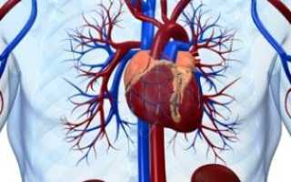 Диффузный кардиосклероз