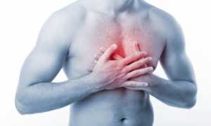 Трансмуральный инфаркт миокарда