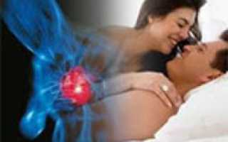 Секс после инфаркта