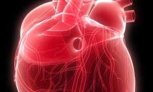 Наджелудочковая пароксизмальная тахикардия