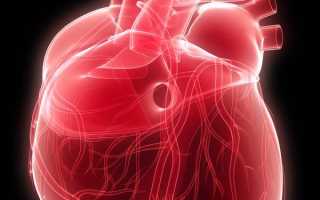 Наджелудочковая пароксизмальная тахикардия