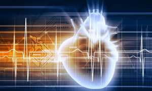 Причины тахикардии