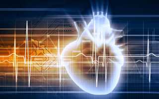 Причины тахикардии