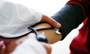 Острая сосудистая недостаточность: обморок, коллапс и шок