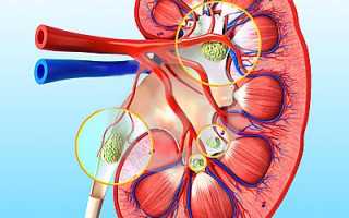 Реноваскулярная гипертензия