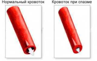 Как снять спазм сосудов головы и шеи