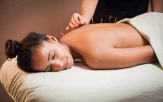 Защемление нерва в спине: что делать, если защемило, симптомы, как лечить