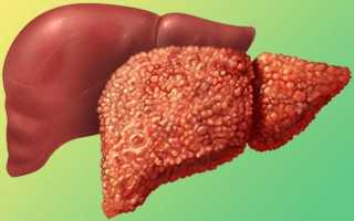 Противовирусные препараты при гепатите C: отзывы о терапии