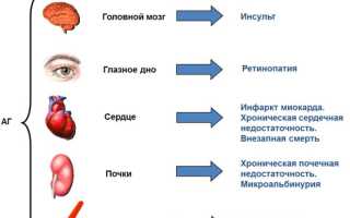 Гипертония 3 степени