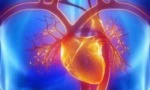 Классификация стенокардии