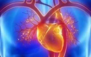 Классификация стенокардии