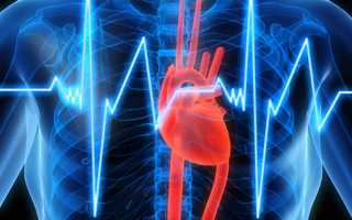 Инвалидность после инфаркта