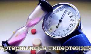 Артериальная гипертензия