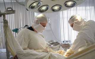 Стентирование сонных артерий