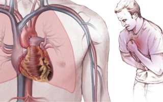 Профилактика стенокардии
