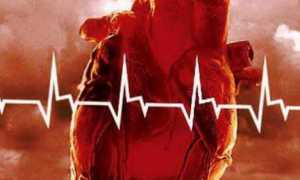 Суправентрикулярная экстрасистолия