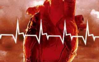 Суправентрикулярная экстрасистолия