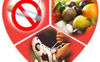 ЛФК при инфаркте миокарда