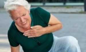 Симптомы инфаркта у женщин