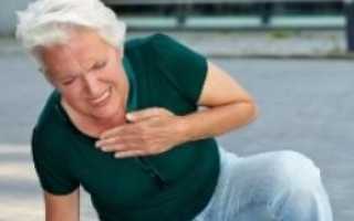 Симптомы инфаркта у женщин