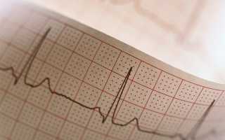 Дистрофические изменения в миокарде