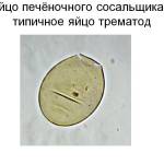 Признаки появления печеночного сосальщика у человека: симптомы и лечение